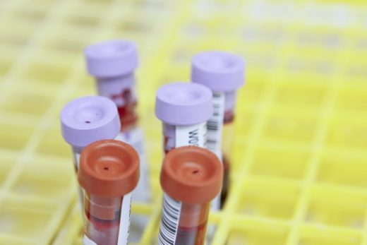 3 Biggest Myths of Cancer