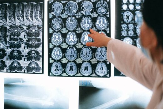 Brain-derived neurotrophic factor